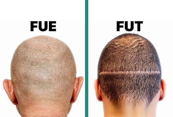 fue and fut difference
