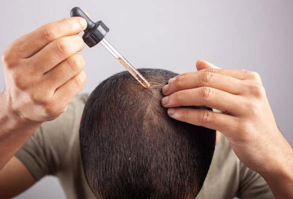 Minoxidil hair regrowth