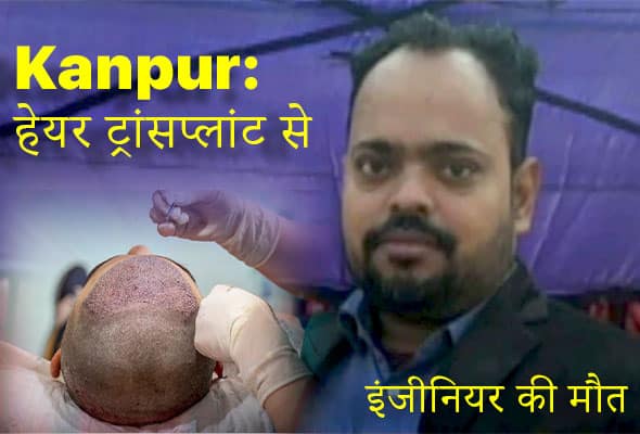 hair transplant infection