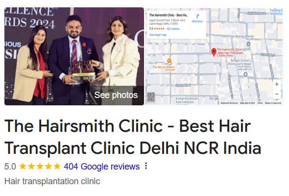 Hairsmith Hair Transplant Clinic – Best Hair Transplant in Delhi India